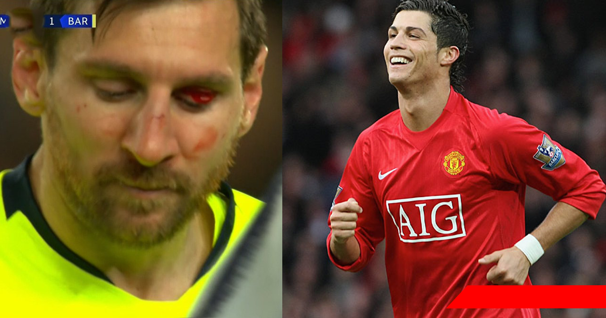 CĐV Man Utd đồng thanh hô vang tên Ronaldo khi Messi đổ m.áu rời sân
